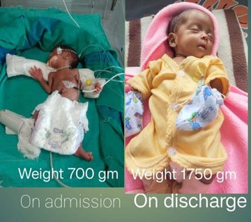(बीजापुर) बीजापुर जिला अस्पताल में नवजात देखभाल की उल्लेखनीय सफलता