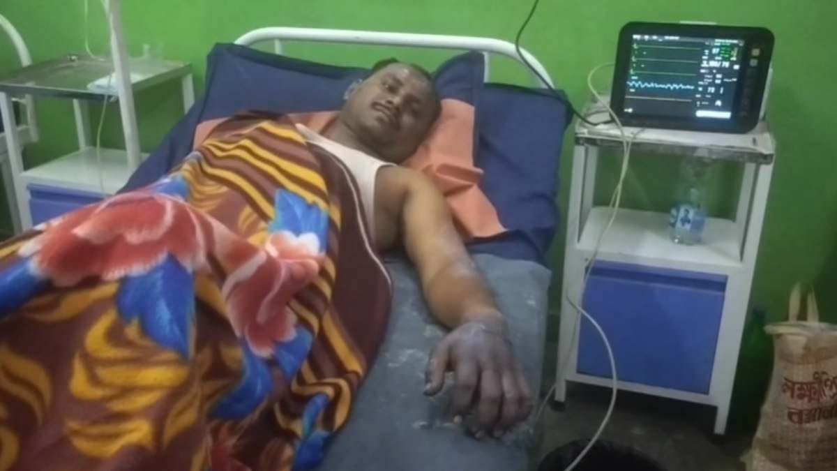 (धरसींवा) स्टील फैक्ट्री में हादसा : भट्टी में काम करते समय बुरी तरह झुलसा श्रमिक
