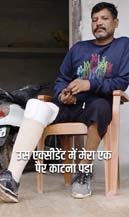 (जशपुरनगर) मुख्यमंत्री की पहल पर नंदकुमार को मिला कृत्रिम पैर