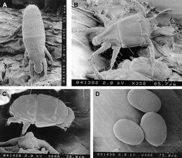 (धमतरी) धान फसल में पेनिकल माइट एवं अन्य कीट-व्याधियों से बचाव के लिए किसानों को सावधान रहने की सलाह