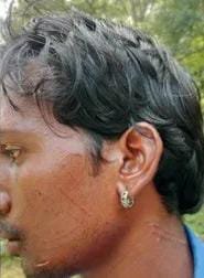 (गरियाबंद) तेंदुए के हमले से युवक गंभीर रूप से घायल