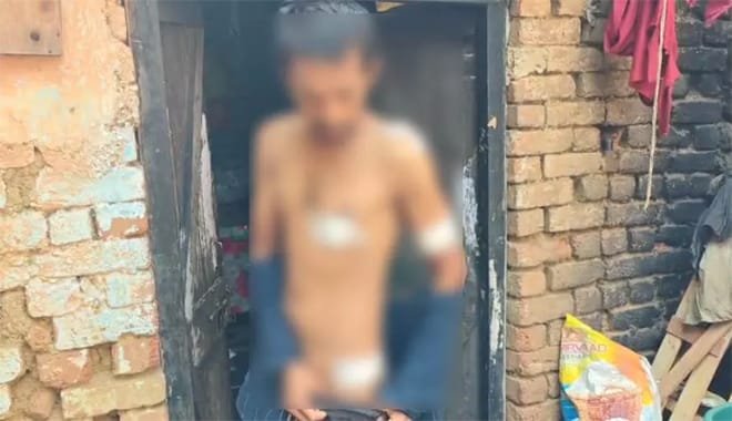 (रायपुर) सनकी आशिक ने प्रेमिका के भाई पर किया जानलेवा हमला, आरोपी गिरफ्तार