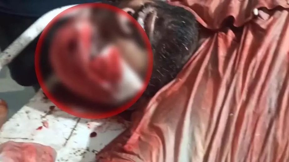 दुर्ग) झगड़े में बीच-बचाव करने पहुंचे युवक की हत्या