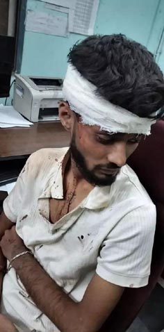 (रायपुर) बीबीए के छात्र से सामूहिक मारपीट, पुलिस विवेचना जारी