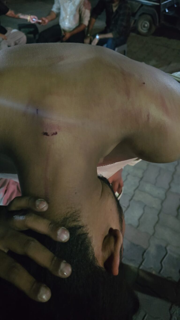 (रायपुर) रायपुर में एमबीबीएस छात्र के से देर रात मारपीट, 20-25 युवकों पर आरोप