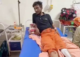 (कोरबा) युवक ने पुलिस पर लगाया मारपीट का गंभीर आरोप, बाएं पैर की जांघ की हड्डी टूटी