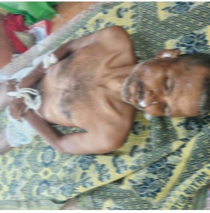 (धमतरी)धमतरी में युवक की संदिग्ध मौत, सिर पर गंभीर चोट के साथ मिला था घायल