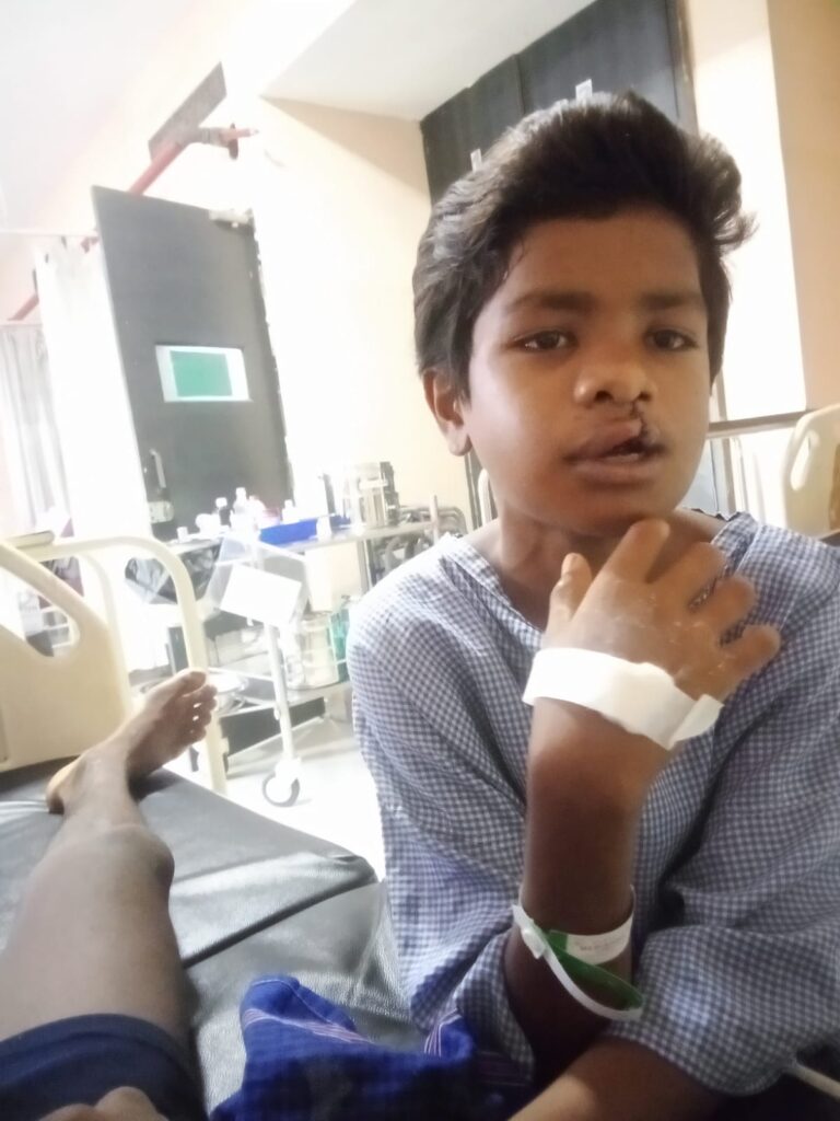 (बीजापुर) आरबीएसके के ‘चिरायु दल ने जन्मजात क्लेफ्ट लिप एवं पैलेट से पीडि़त बालक को दिलाई नई मुस्कान