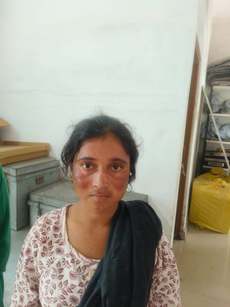 (रायगढ़) मॉल के ट्रांसफार्मर से तांबे का अर्थिंग वायर चोरी करने वाले दो नाबालिग समेत पांच आरोपी पकड़ाए