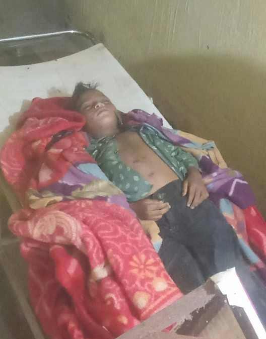 (सरगुजा) आकाशीय बिजली का कहर: दो बच्चों की मौत, दो सगे भाई झुलसे